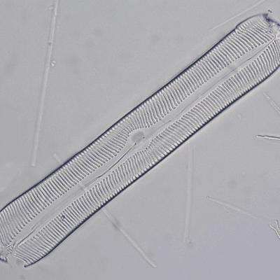 Diatom 400x Magnification Taken Using The Olympus CX23 Compound Microscope