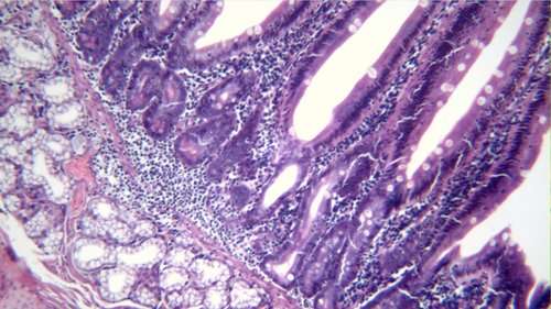 Getting The Most From Your Compound Microscope Getting the most from your compound microscope
