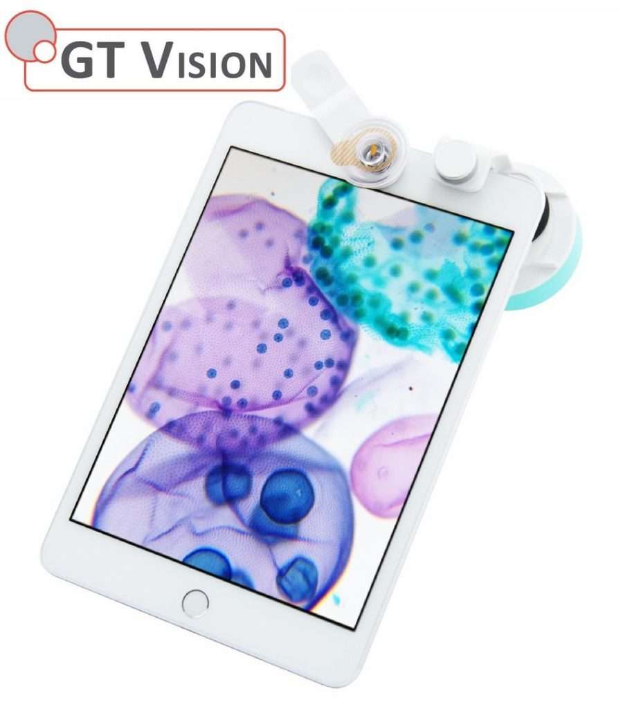 uHandy bee under microscope