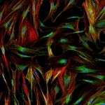 Fluorescence Microscopy